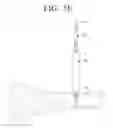 Fig. 10 - Fixing pin for orthopedic surgery enabling internal fixation