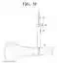 Fig. 11 - Fixing pin for orthopedic surgery enabling internal fixation