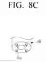 Fig. 22 - Fixing pin for orthopedic surgery enabling internal fixation