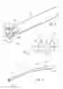 Fig. 03 - Torsional orthopaedic revision system