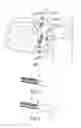 Fig. 04 - Method for selectively elevating and separating tissue layers and surgical instrument for performing the method