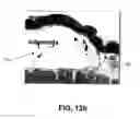 Fig. 09 - Method for selectively elevating and separating tissue layers and surgical instrument for performing the method