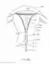 Fig. 12 - Systems and methods for endometrial ablation