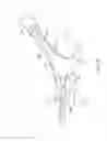 Fig. 13 - Systems and methods for endometrial ablation