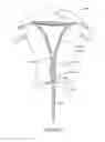 Fig. 20 - Systems and methods for endometrial ablation