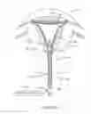 Fig. 27 - Systems and methods for endometrial ablation