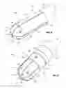 Fig. 05 - Multi-electrode ablator tip having dual-mode, omni-directional feedback capabilities