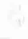 Fig. 15 - Catheter with omni-directional optical tip having isolated optical paths