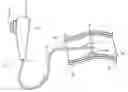 Fig. 01 - Laser-based surgical systems and related methods