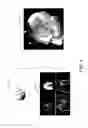 Fig. 05 - Method and system for trackerless image guided soft tissue surgery and applications of same