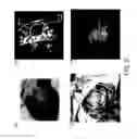Fig. 07 - Method and system for trackerless image guided soft tissue surgery and applications of same
