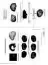 Fig. 14 - Method and system for trackerless image guided soft tissue surgery and applications of same