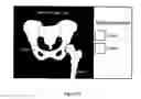 Fig. 23 - Systems, methods and devices for image registration and surgical localization