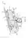Fig. 12 - Techniques and instruments for placement of orthopedic implants relative to bone features