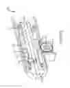 Fig. 14 - Techniques and instruments for placement of orthopedic implants relative to bone features