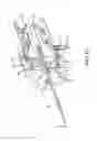Fig. 26 - Techniques and instruments for placement of orthopedic implants relative to bone features