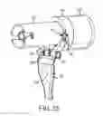 Fig. 32 - Techniques and instruments for placement of orthopedic implants relative to bone features