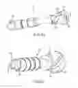 Fig. 55 - Techniques and instruments for placement of orthopedic implants relative to bone features