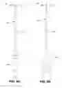 Fig. 08 - ENDODONTIC INSTRUMENTS AND ROOT CANAL TREATMENT METHODS