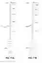 Fig. 10 - ENDODONTIC INSTRUMENTS AND ROOT CANAL TREATMENT METHODS