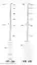Fig. 11 - ENDODONTIC INSTRUMENTS AND ROOT CANAL TREATMENT METHODS