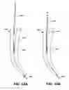 Fig. 14 - ENDODONTIC INSTRUMENTS AND ROOT CANAL TREATMENT METHODS