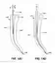 Fig. 15 - ENDODONTIC INSTRUMENTS AND ROOT CANAL TREATMENT METHODS