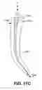 Fig. 22 - ENDODONTIC INSTRUMENTS AND ROOT CANAL TREATMENT METHODS