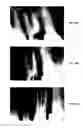 Fig. 32 - ENDODONTIC INSTRUMENTS AND ROOT CANAL TREATMENT METHODS