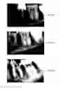 Fig. 34 - ENDODONTIC INSTRUMENTS AND ROOT CANAL TREATMENT METHODS