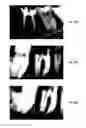 Fig. 35 - ENDODONTIC INSTRUMENTS AND ROOT CANAL TREATMENT METHODS