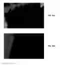 Fig. 40 - ENDODONTIC INSTRUMENTS AND ROOT CANAL TREATMENT METHODS