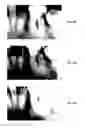 Fig. 43 - ENDODONTIC INSTRUMENTS AND ROOT CANAL TREATMENT METHODS