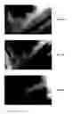 Fig. 45 - ENDODONTIC INSTRUMENTS AND ROOT CANAL TREATMENT METHODS
