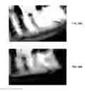 Fig. 47 - ENDODONTIC INSTRUMENTS AND ROOT CANAL TREATMENT METHODS