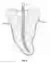 Fig. 05 - Cross-Fluted Endodontic Instrument