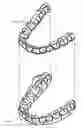 Fig. 01 - Tactile objects for orthodontics, systems and methods