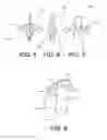 Fig. 04 - Implant fixation devices and methods of using the same