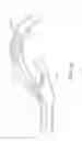 Fig. 07 - Retrieval catheter