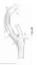 Fig. 08 - Retrieval catheter