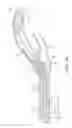Fig. 10 - Retrieval catheter