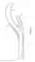 Fig. 14 - Retrieval catheter