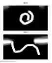 Fig. 16 - COVERED STENT AND PREPARATION METHOD THEREFOR