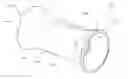 Fig. 01 - Intravascular device for hemiarch repair and associated method