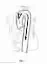 Fig. 02 - Intravascular device for hemiarch repair and associated method