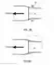 Fig. 12 - Intravascular device for hemiarch repair and associated method