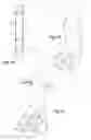 Fig. 02 - REMOVABLE IMPLANT FOR GENERATING A TENDON OR A LIGAMENT