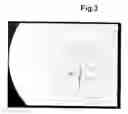 Fig. 05 - REMOVABLE IMPLANT FOR GENERATING A TENDON OR A LIGAMENT