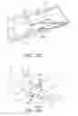 Fig. 04 - Reinforced biological construct and method of reinforcing biological construct