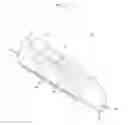 Fig. 03 - Femoral fixation